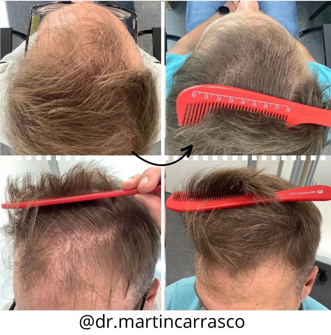 Pablo Martín Carrasco-15