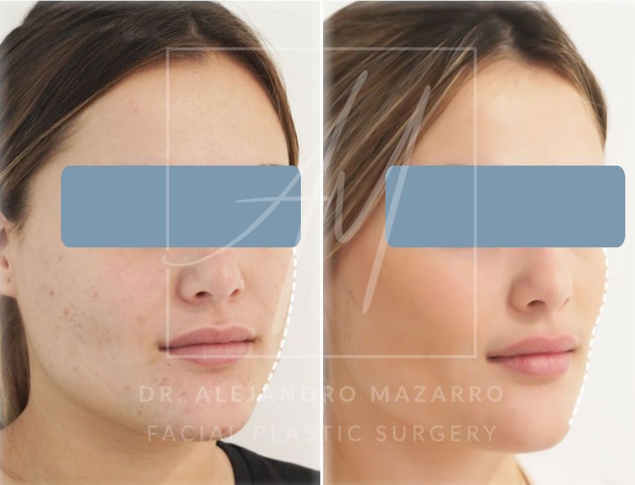 Alejandro Mazarro Campos-4