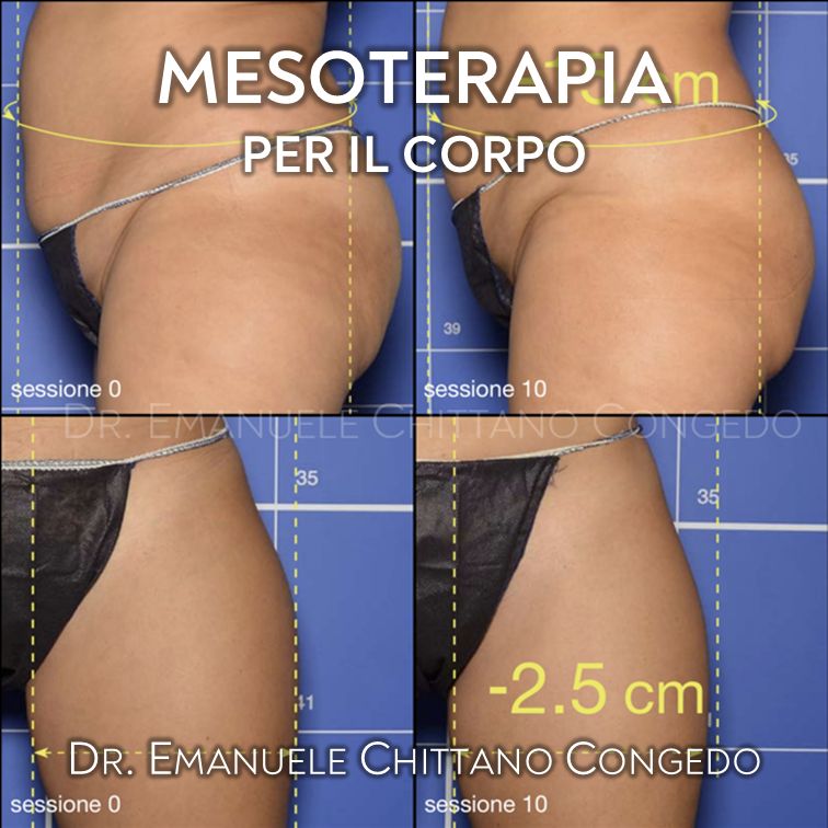 Emanuele Chittano Congedo-17