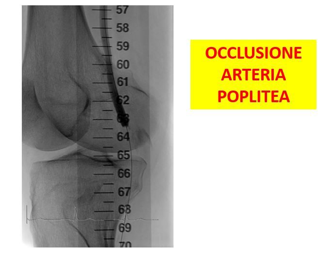 Gianni De Angelis-10