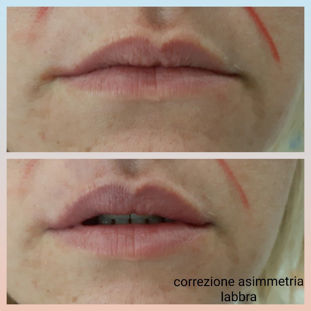 Paola Della Rocca-20