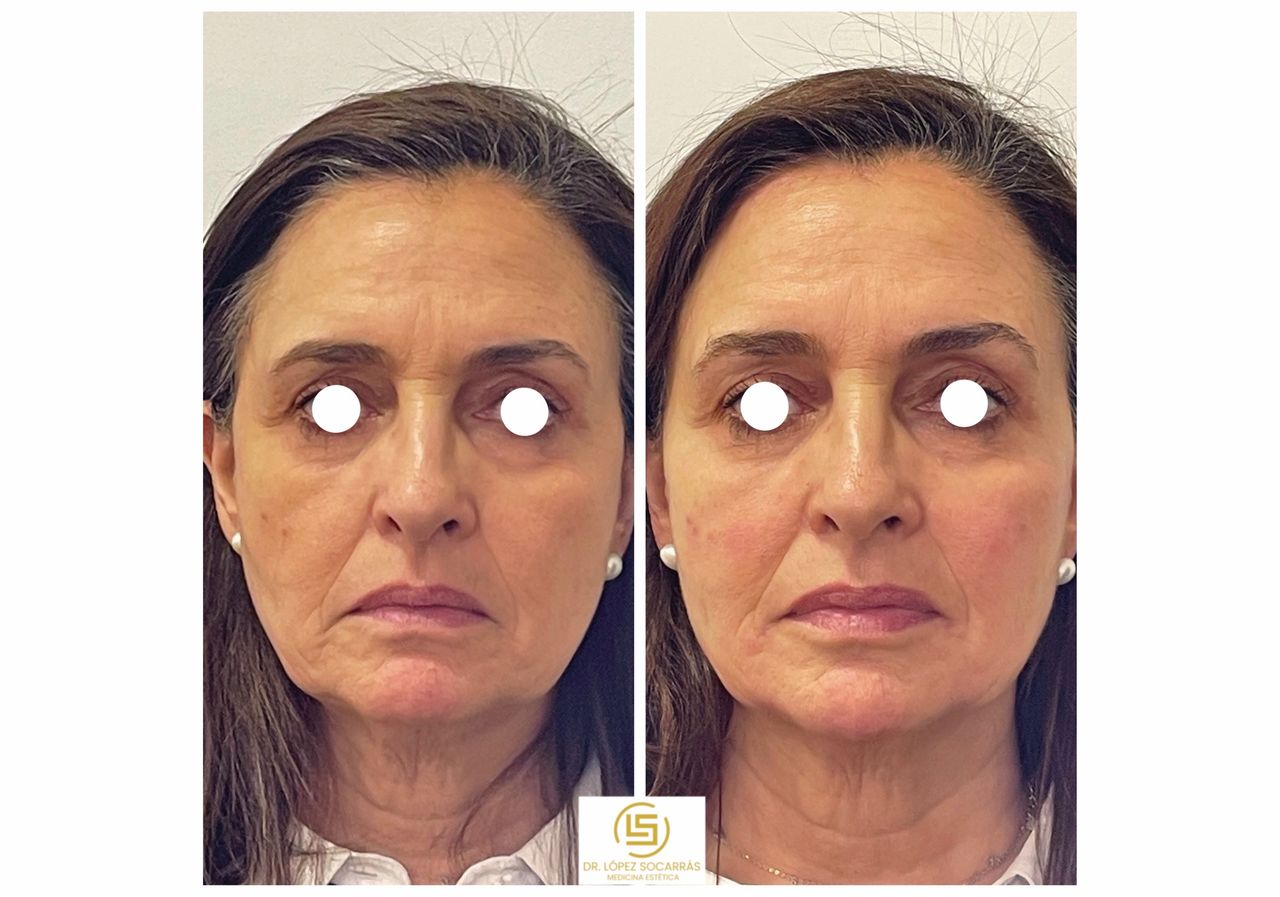 Camilo López Socarrás-16