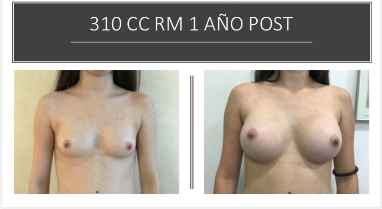 Esther Espinel Pérez-6