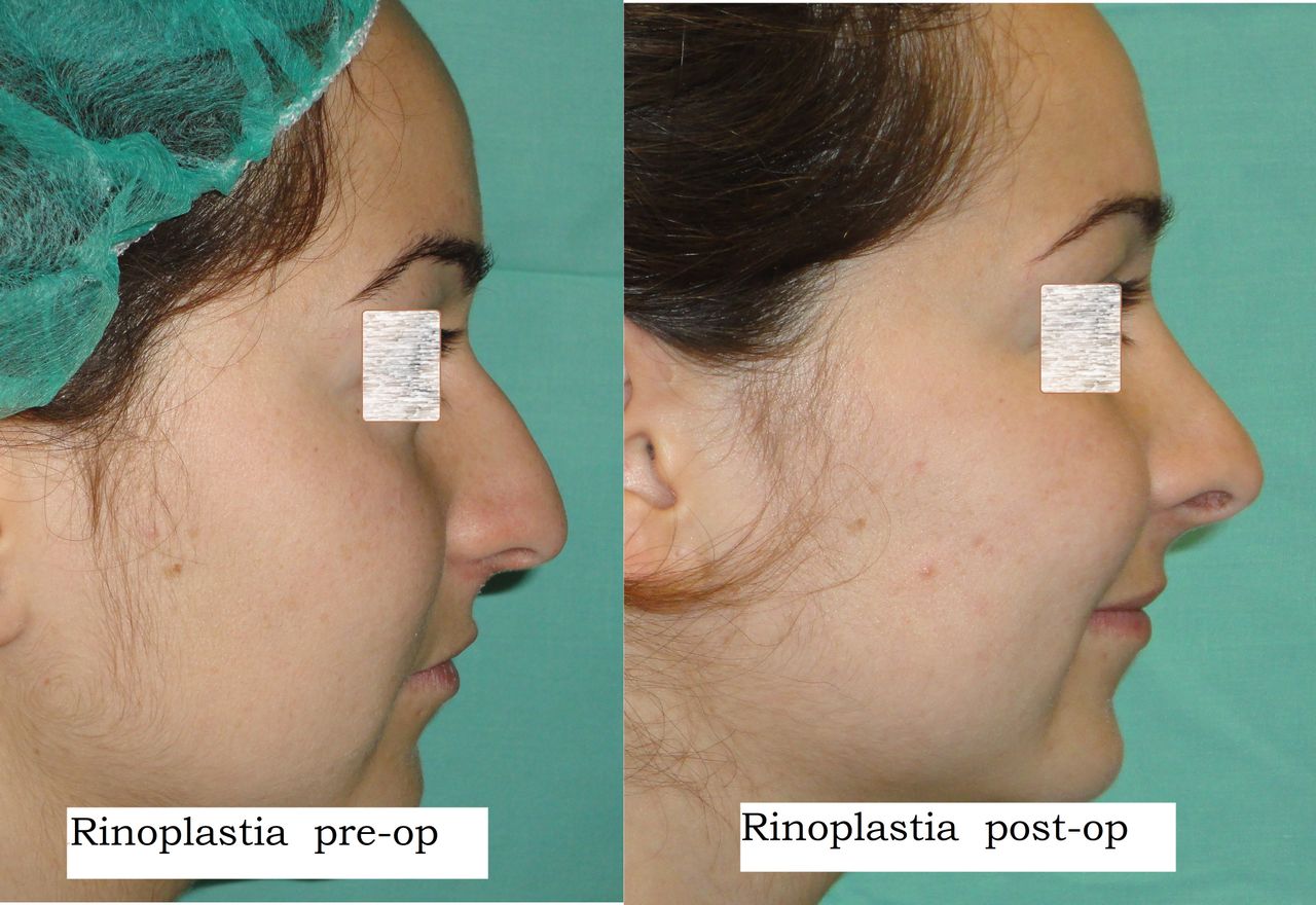 Enrique Bonanad Fernandez-5