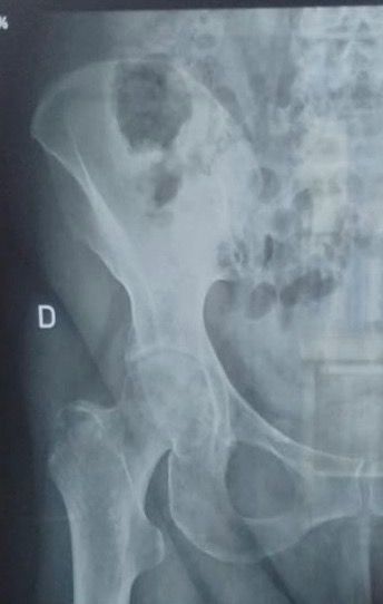 Salvatore Santagata-0