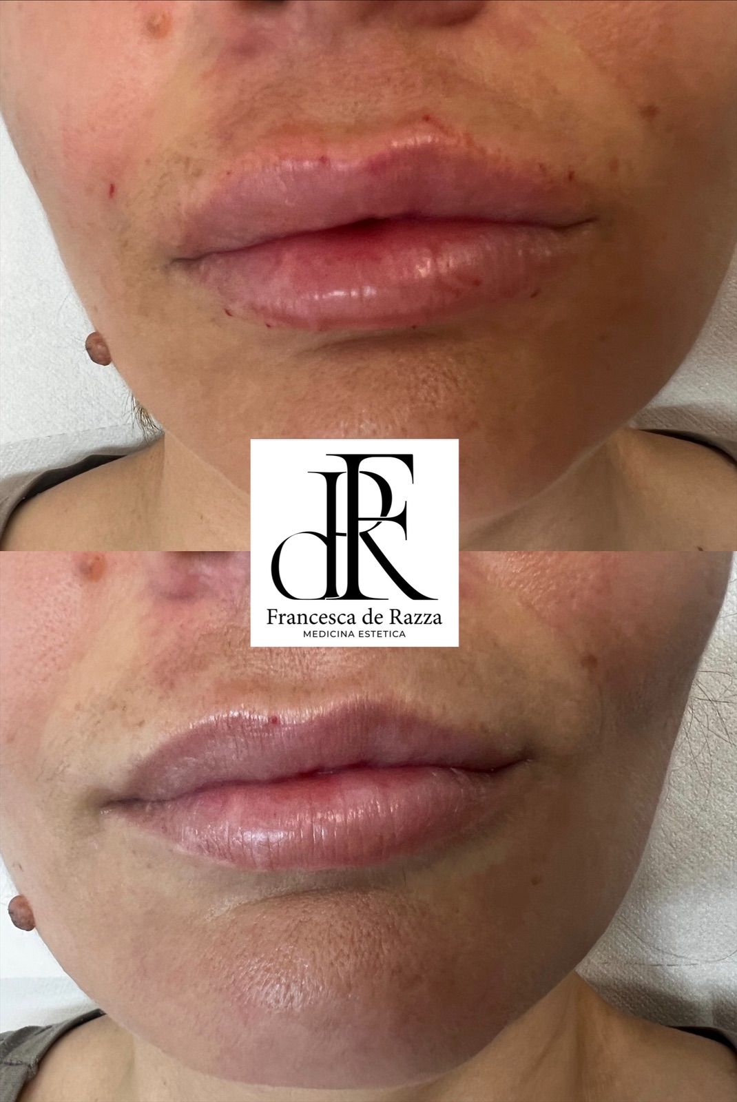 Francesca De Razza-62