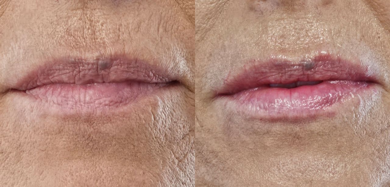 Rosalba Herrero Zerpa-40