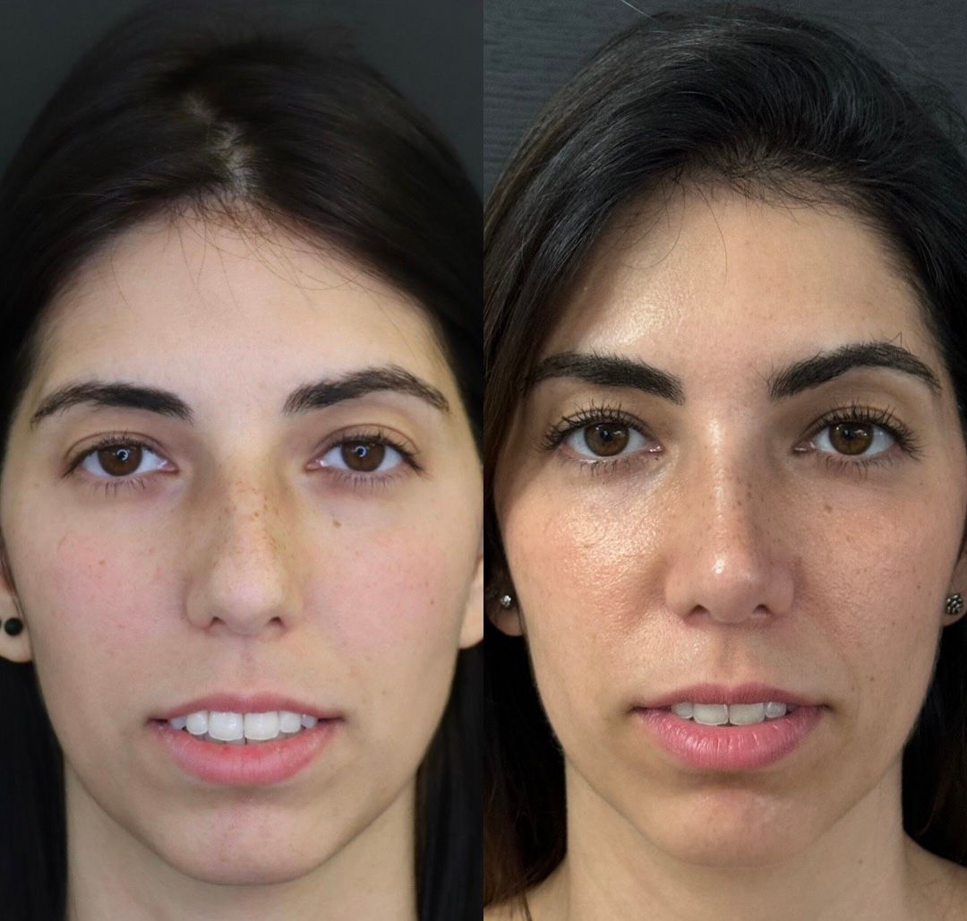 Pier Paolo Ferretti-1