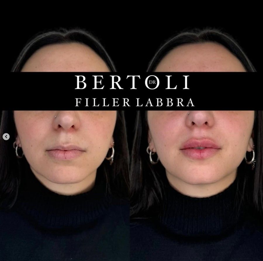 Andrea Bertoli-13