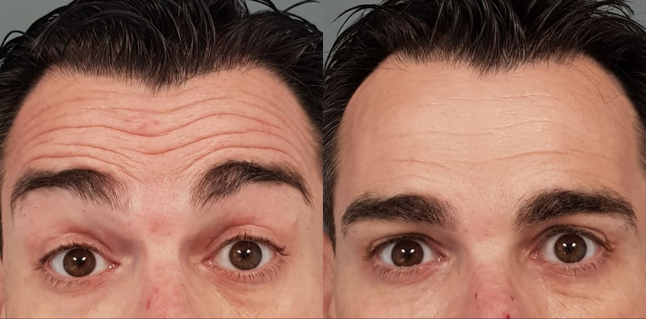 Rosalba Herrero Zerpa-154