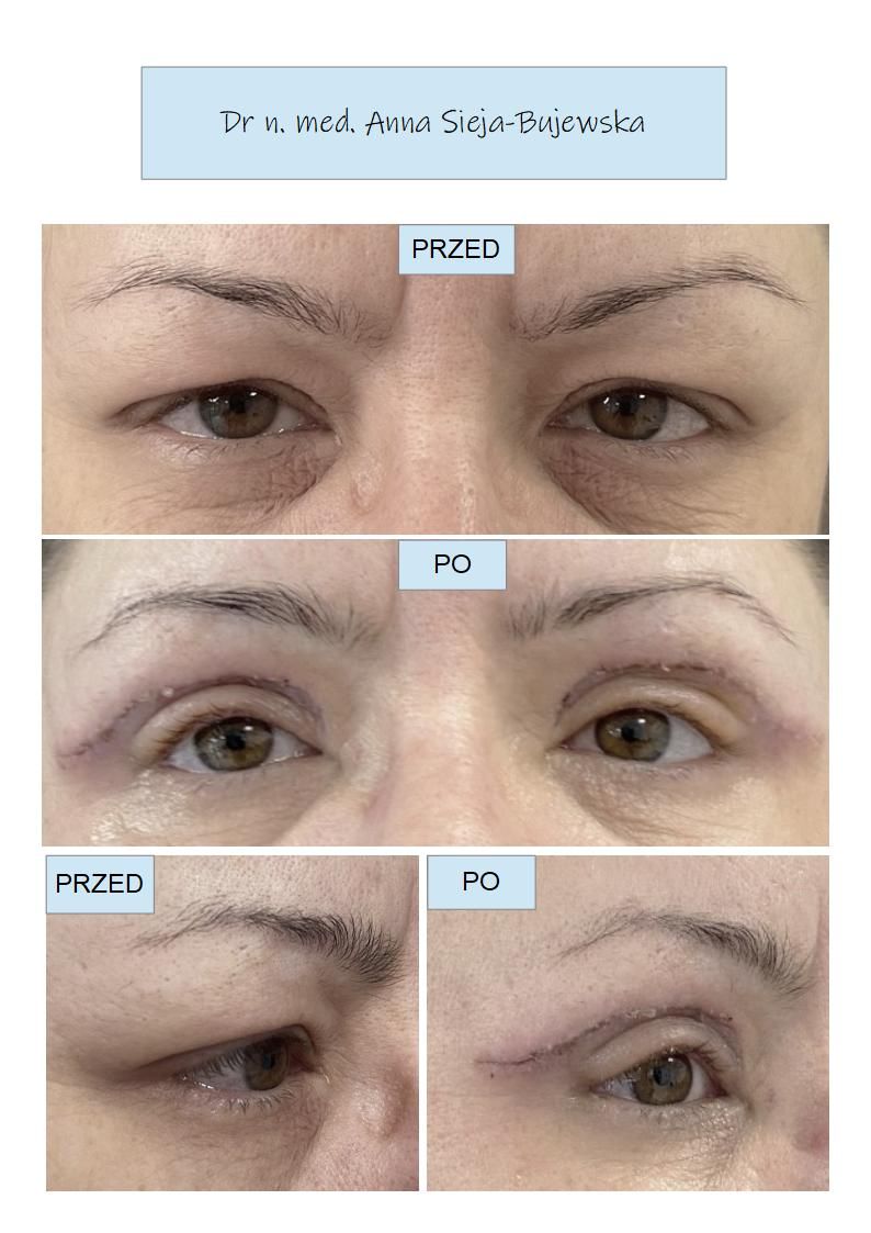 Anna Sieja-Bujewska-11