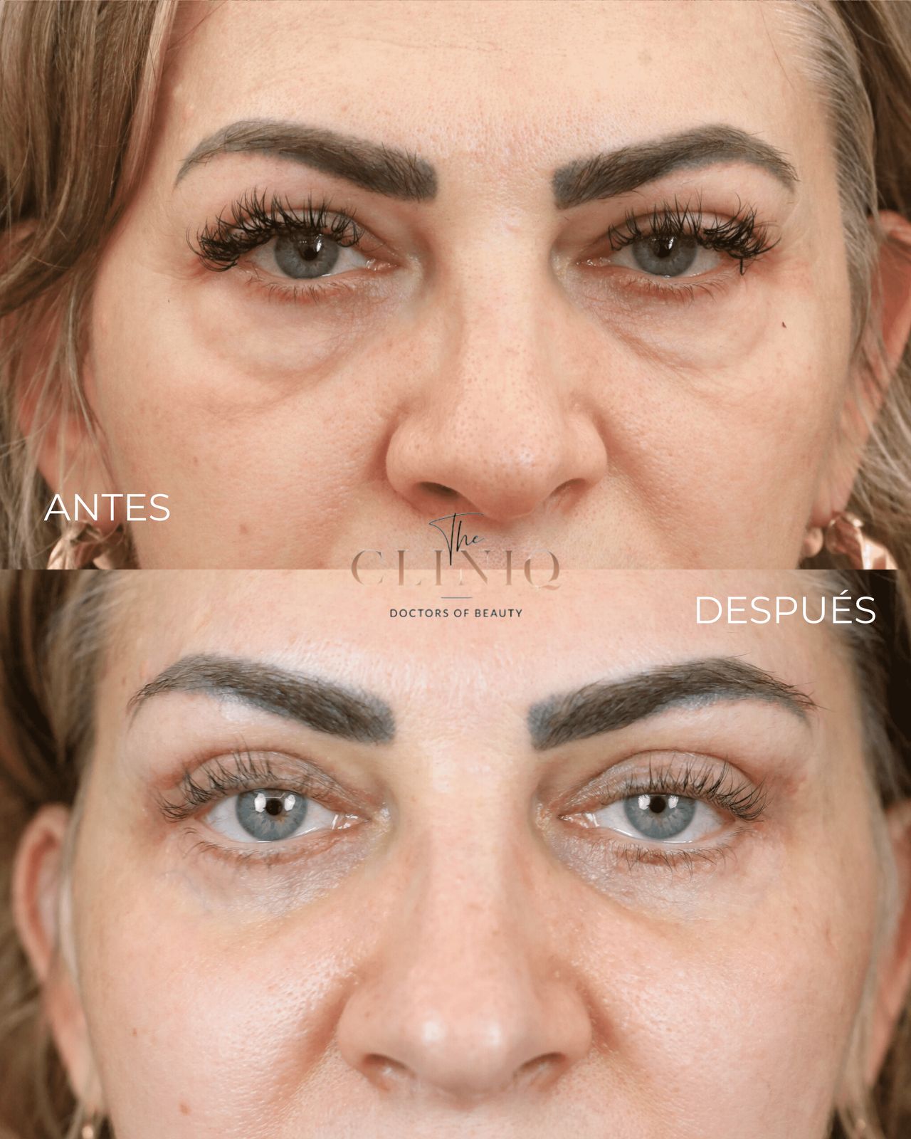 Ignacio Genol Saavedra-5