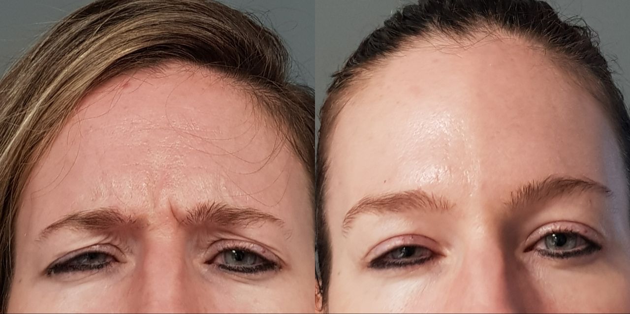 Rosalba Herrero Zerpa-488