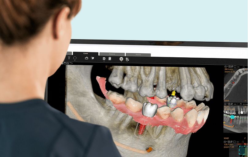 Roberto Giovannini-0