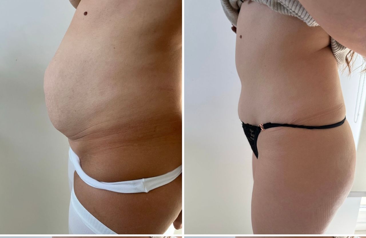 Fabrizio Barattolo-19