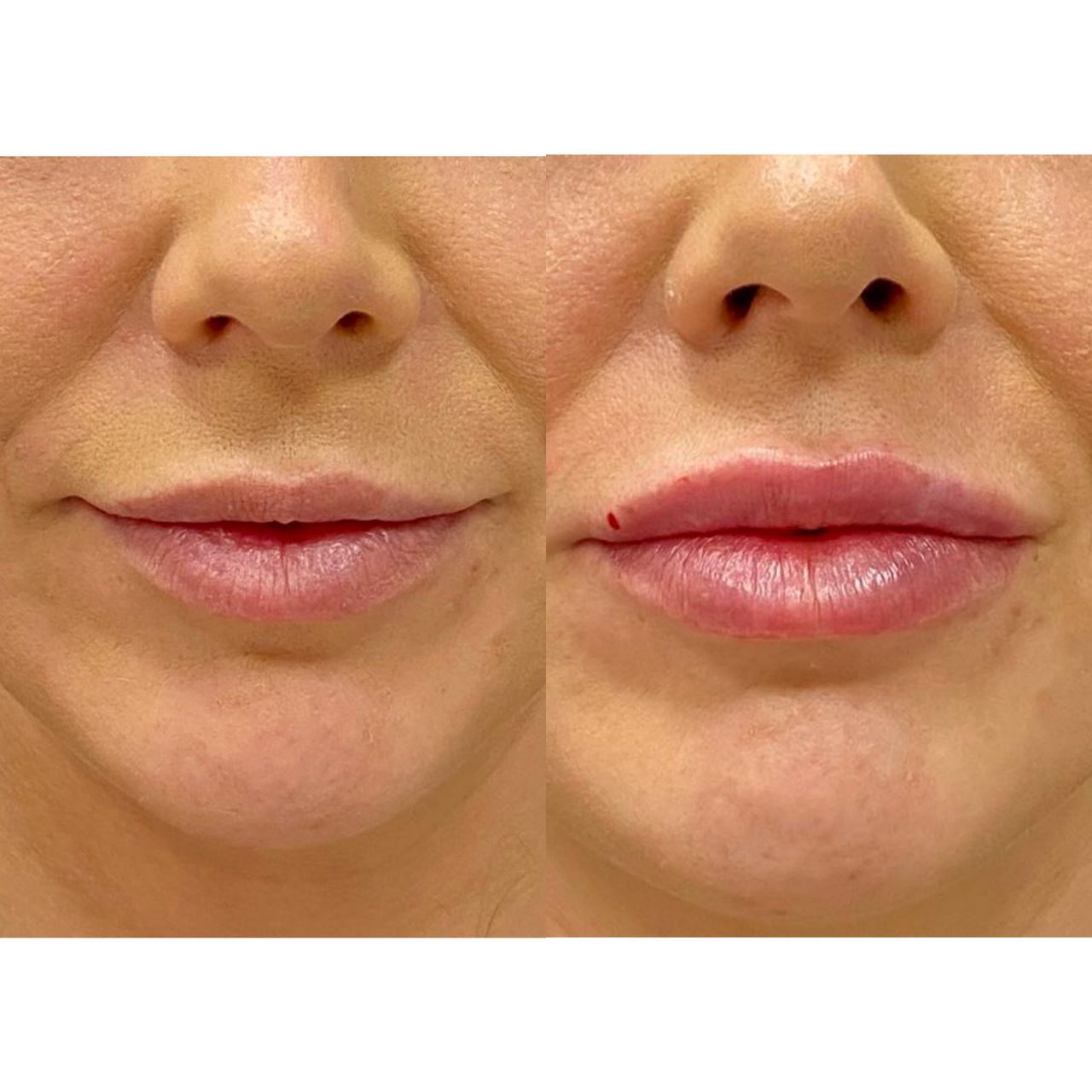 Ewa Wesołowska - Szepietowska-13