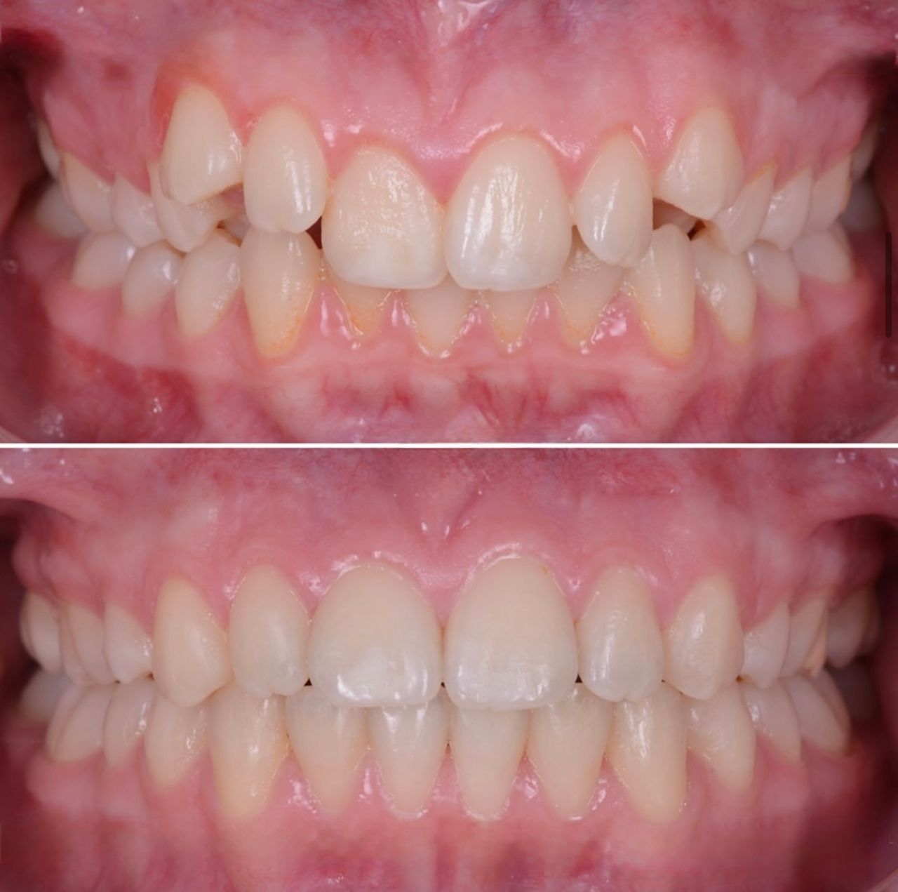 Francesco Sorrentino-7