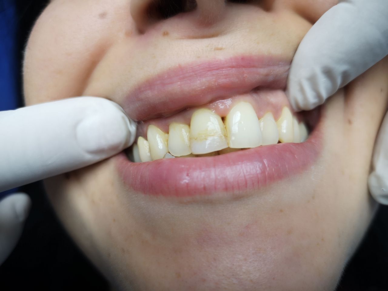 Stefano De Simone-67