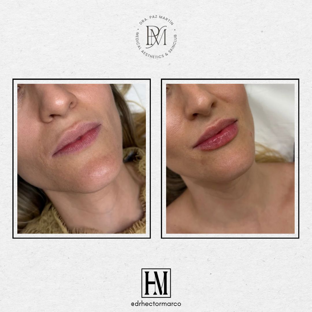 Héctor Marco Ruiz-11