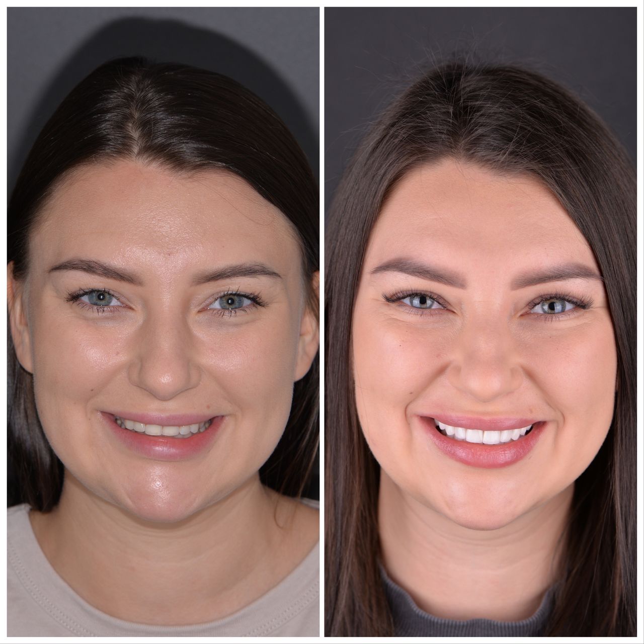 Martin Bartoszcze-37