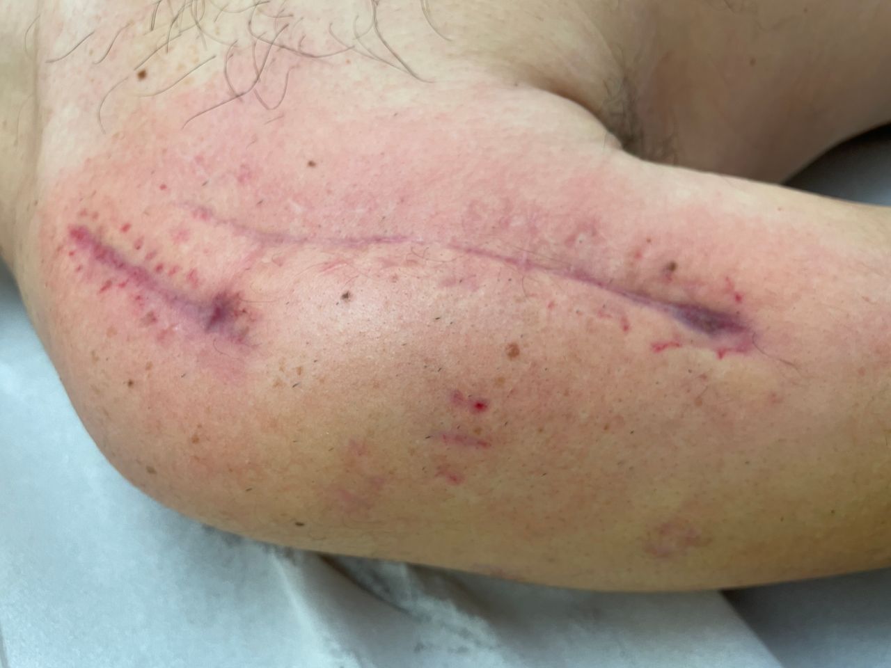 Giuseppe Lombardo-51