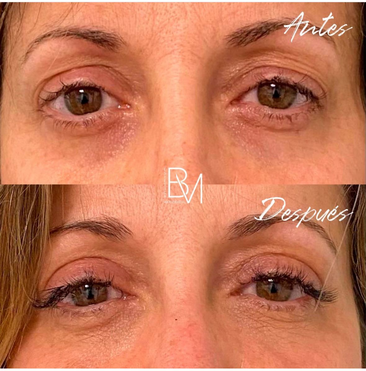 Beatriz Moralejo-85