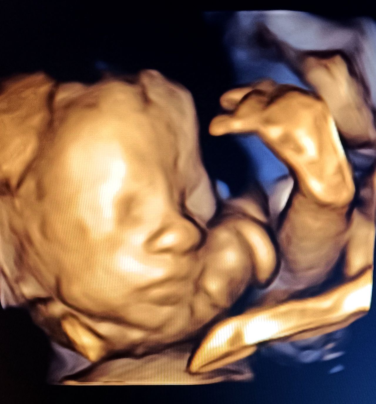 Nicoletta Vendola-11