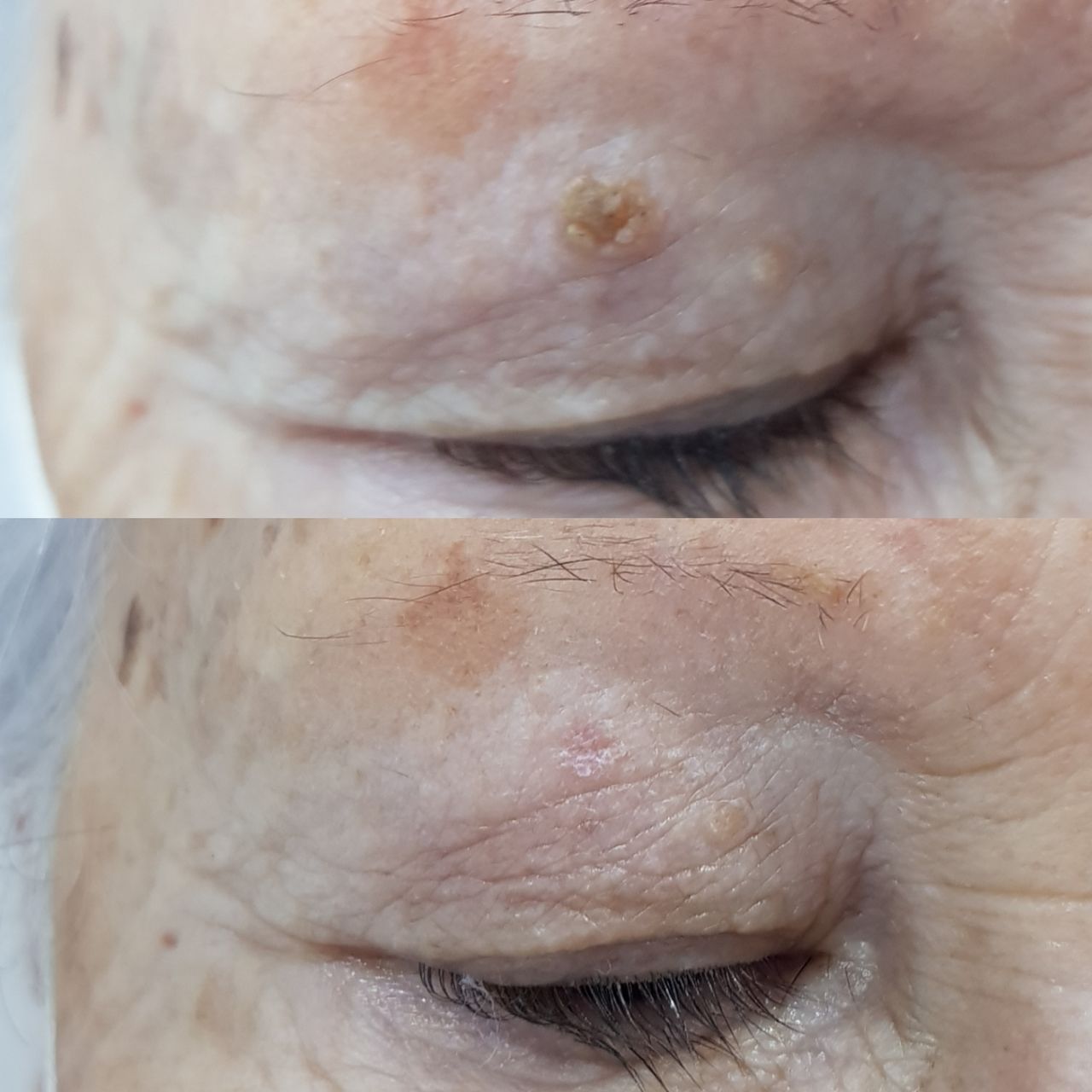 Rosalba Herrero Zerpa-211