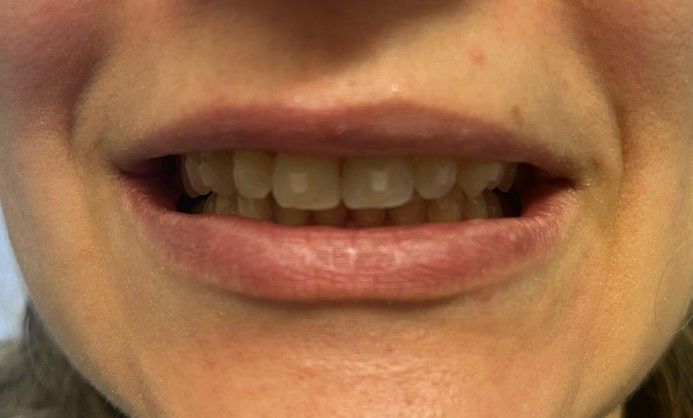 Riunito Dentista Dentalpar-13