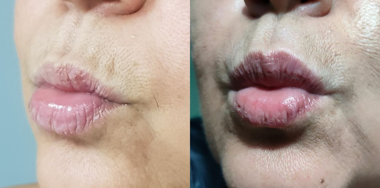 Rosalba Herrero Zerpa-61