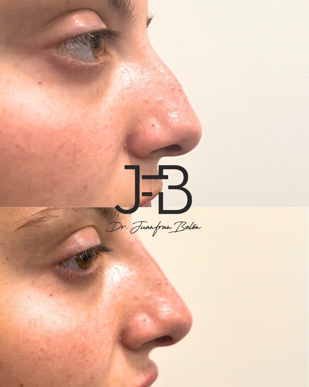 Juan Francisco Belén Montero-18