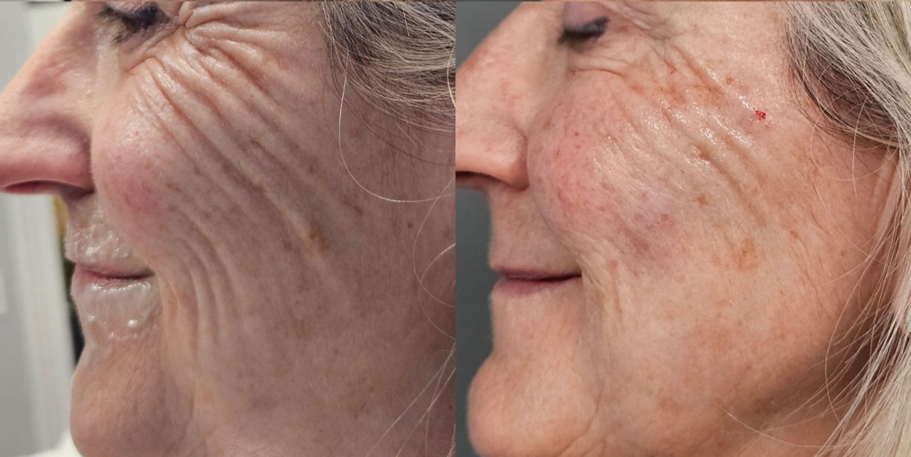 Rosalba Herrero Zerpa-17