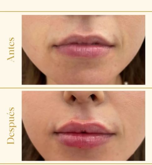 Adrian Grasso Flores-0