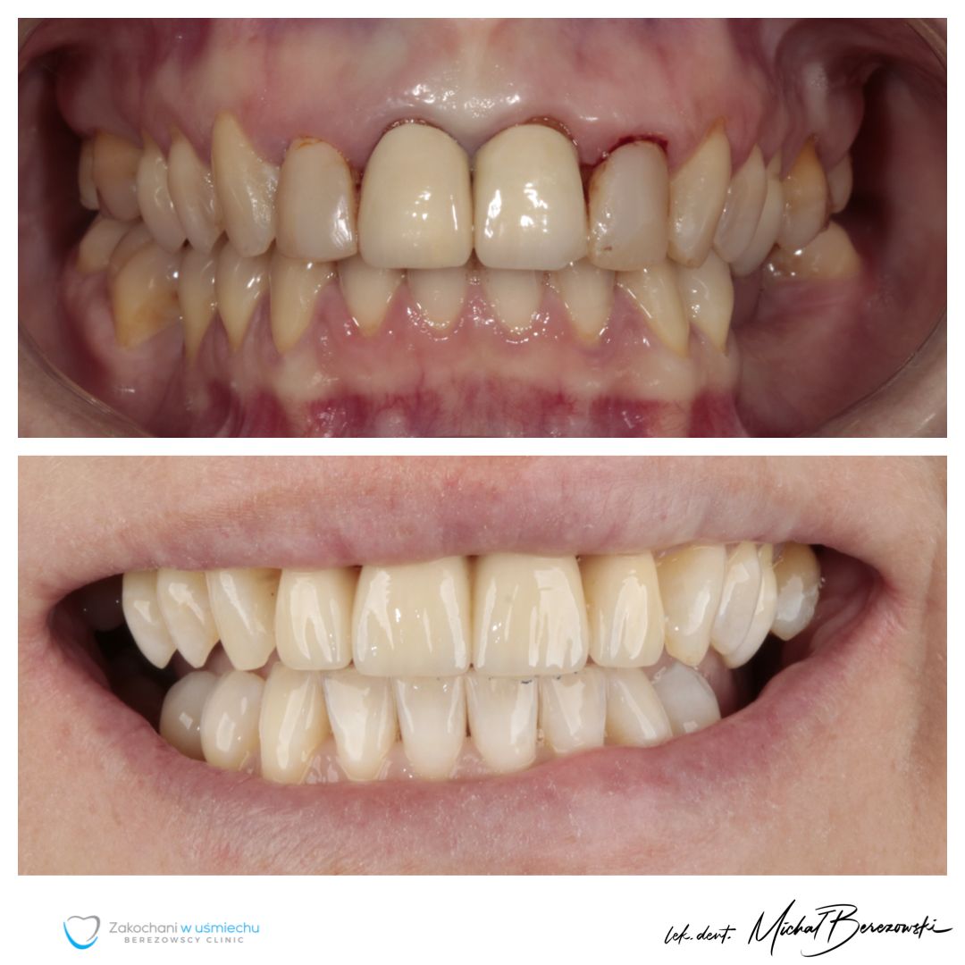 Michał Berezowski-4