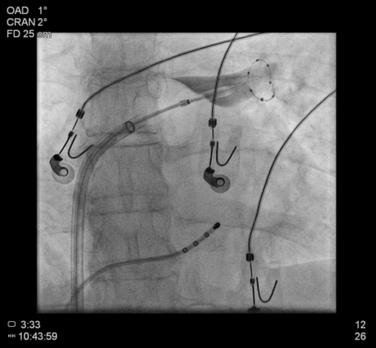 Ernesto Diaz Infante-9