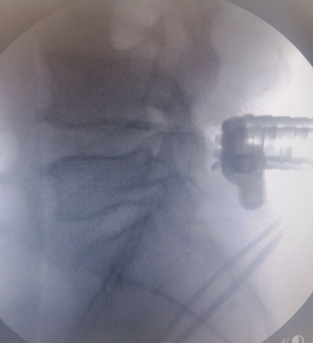 Alessandro Rapisarda-20