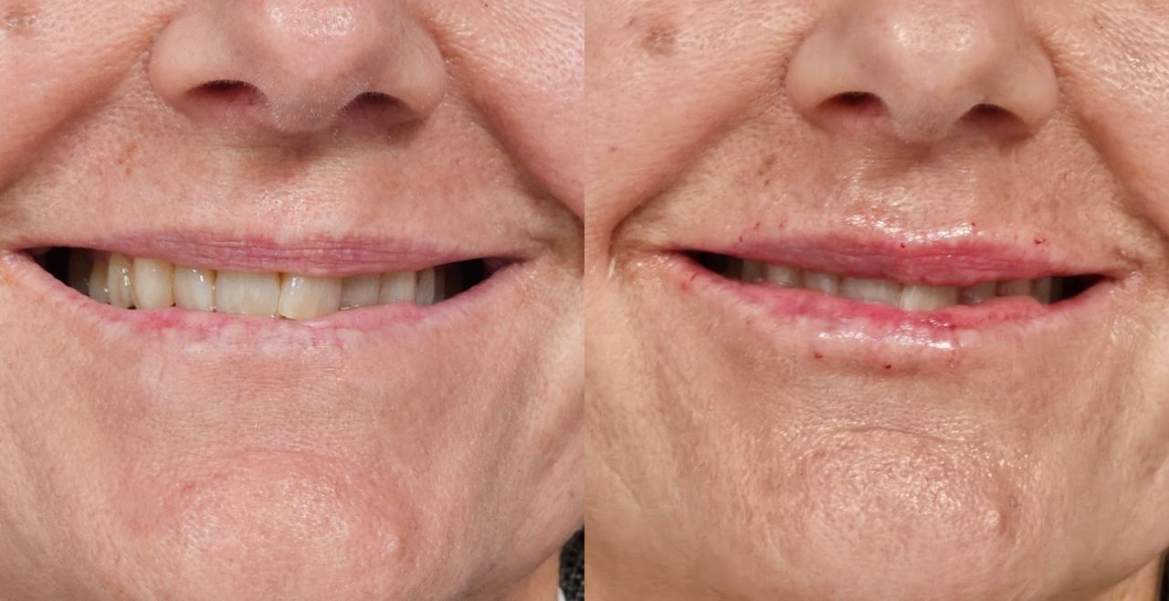 Rosalba Herrero Zerpa-516