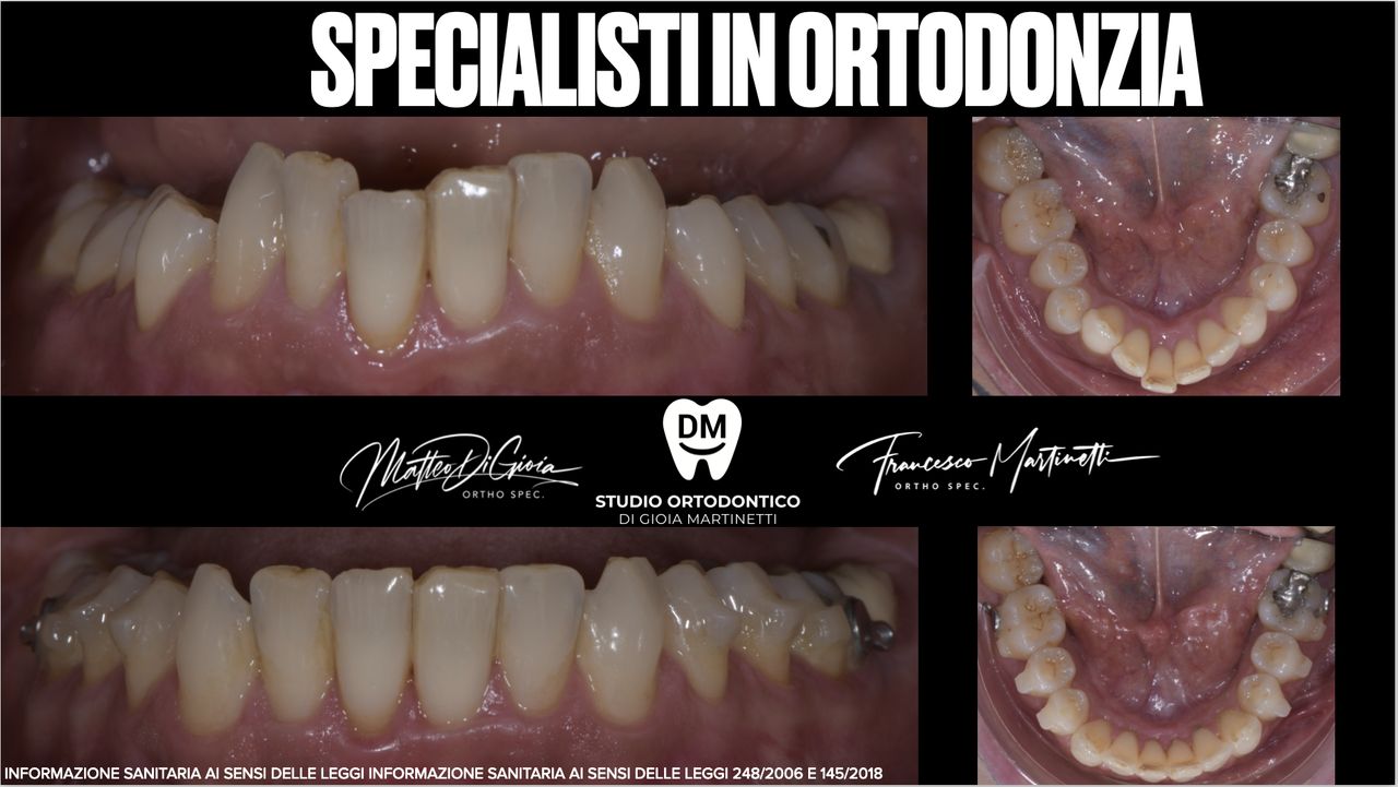 Francesco Martinetti-8