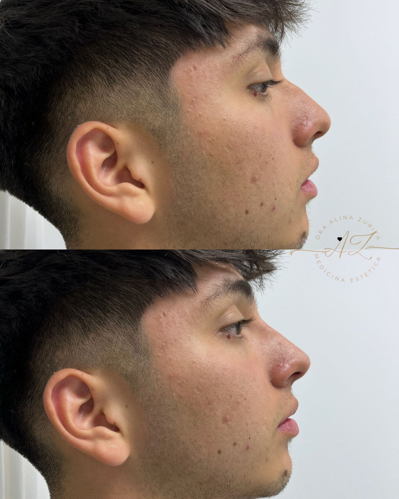 Alina Zurita Estarrona-2