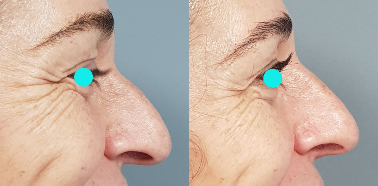 Rosalba Herrero Zerpa-5