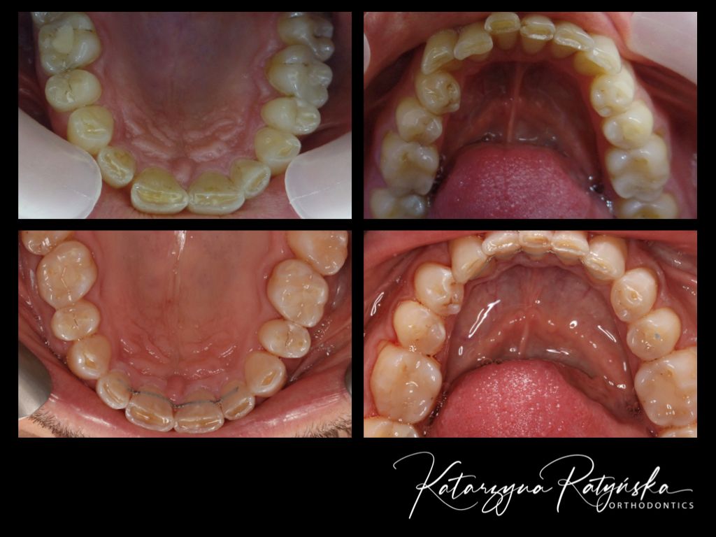 Katarzyna Ratyńska-8