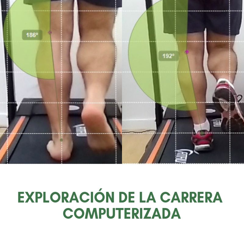 Salomé Antón Arnal-30