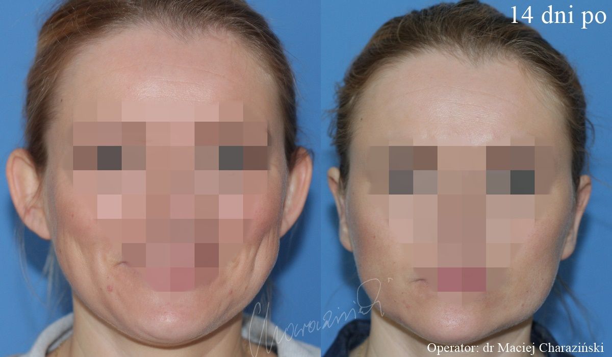 Maciej Charaziński-133