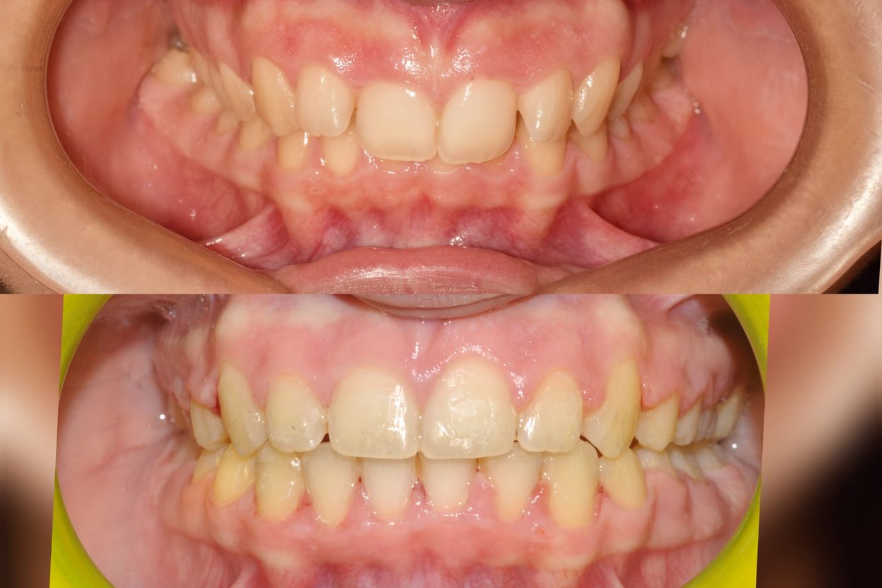 Gianluca Del Vecchio-188