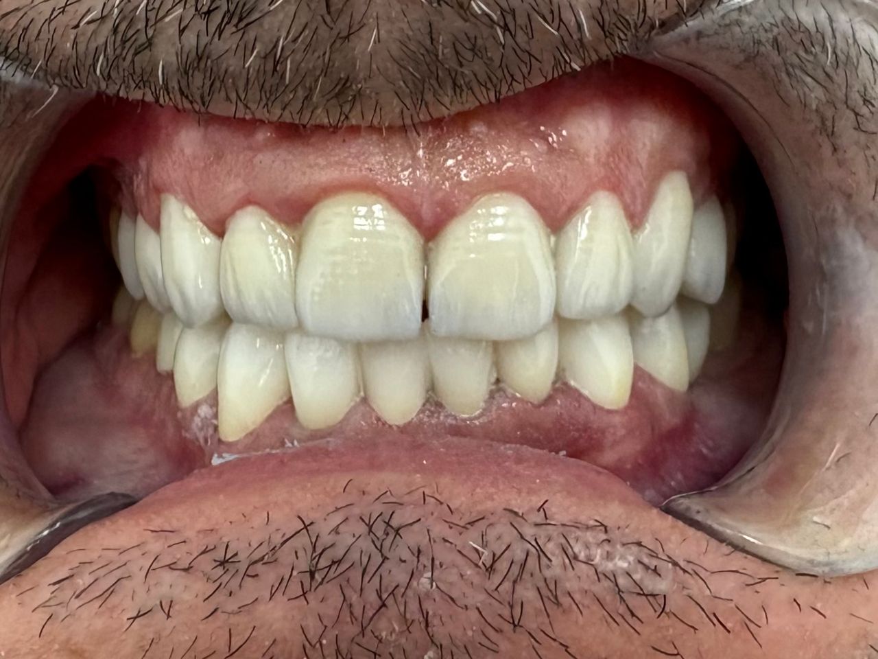 César Buján Riveiro-9