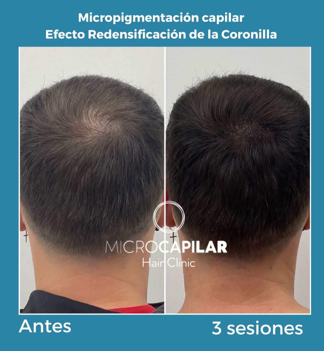 Antonio Fernández Brito-6