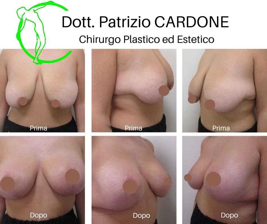 Patrizio Cardone-7