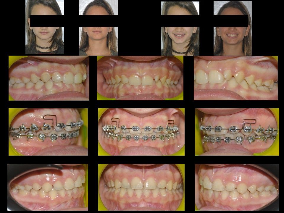 Gianluca Del Vecchio-10