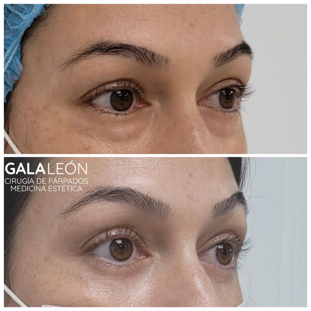 Gala P. Leon Salvatierra-36