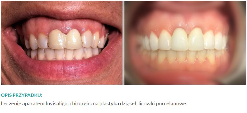 Małgorzata Wiechowska-3